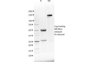 SDS-PAGE Analysis Purified NKX2. (NKX2-8 antibody  (AA 10-123))