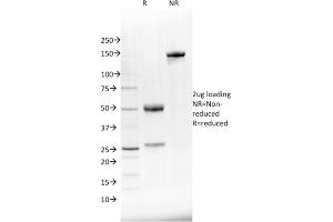 SDS-PAGE Analysis Purified NKX2.