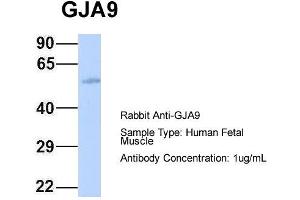 Host: Rabbit Target Name: GJA9 Sample Type: Human Fetal Muscle Antibody Dilution: 1. (GJA9 antibody  (Middle Region))