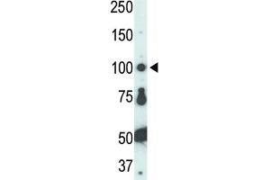 Western Blotting (WB) image for anti-FER Tyrosine Kinase (FER) antibody (ABIN3003442)