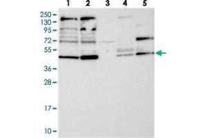 Western blot analysis of Lane 1: RT-4, Lane 2: U-251 MG, Lane 3: Human Plasma, Lane 4: Liver, Lane 5: Tonsil with RNF44 polyclonal antibody  at 1:250-1:500 dilution.