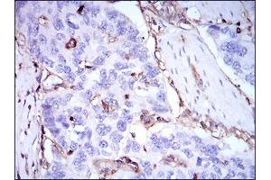 Immunohistochemistry (IHC) image for anti-beta-2-Microglobulin (B2M) (AA 21-100) antibody (ABIN1724930)