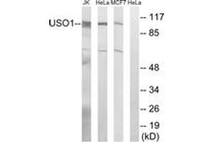 Western blot analysis of extracts from MCF-7/HeLa/Jurkat cells, using USO1 Antibody.