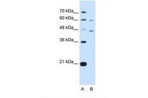 Image no. 1 for anti-Cysteine-Rich with EGF-Like Domains 1 (CRELD1) (AA 311-360) antibody (ABIN320904) (CRELD1 antibody  (AA 311-360))