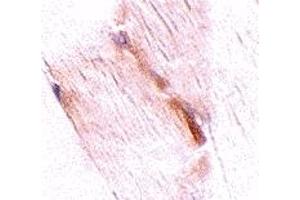Immunohistochemistry (IHC) image for anti-Glioblastoma Amplified Sequence (GBAS) (Middle Region) antibody (ABIN1031016) (GBAS antibody  (Middle Region))