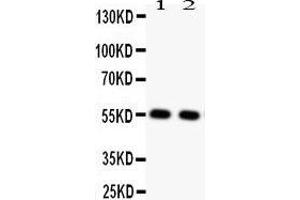 Anti-GLUT4 Picoband antibody,  All lanes: Anti GLUT4  at 0. (GLUT4 antibody  (AA 333-509))