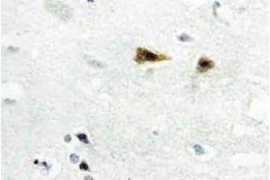 Immunohistochemistry analysis of c-Abl Antibody in paraffin-embedded human brain tissue. (ABL1 antibody)