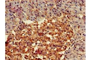 Immunohistochemistry of paraffin-embedded human pancreatic tissue using ABIN7153185 at dilution of 1:100 (FZD4 antibody  (AA 37-222))