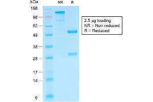 SDS-PAGE Analysis of Purified hCG beta Rabbit Recombinant Monoclonal Antibody (HCGb/1985R). (Recombinant CGB antibody)