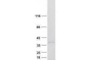 Validation with Western Blot