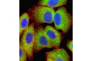 Fluorescent confocal image of  cell stained with RELA Antibody (Center) (ABIN1881740 and ABIN2838805). (NF-kB p65 antibody  (AA 166-195))