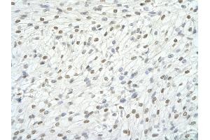 Rabbit Anti-RBM9 antibody   Paraffin Embedded Tissue: Human Heart cell Cellular Data: cardiac cell of renal tubule Antibody Concentration: 4.