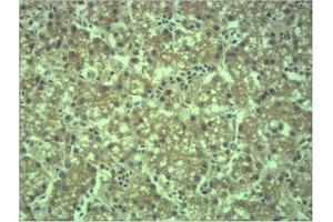 Immunohistochemistry (IHC) analysis of paraffin-embedded Mouse Liver Tissue using EPG5 Polyclonal Antibody. (EPG5 antibody)