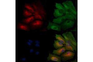 ABIN6259432 and ABIN6276261 staining  cells by IF/ICC.