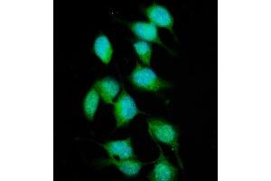anti-Xeroderma Pigmentosum, Complementation Group C (XPC) (AA 146-838) antibody