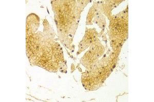 Immunohistochemistry of paraffin-embedded Human esophageal using BSG antibody at dilution of 1:100 (x400 lens). (CD147 antibody  (AA 30-200))