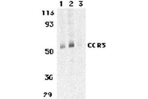 Western Blotting (WB) image for anti-Chemokine (C-C Motif) Receptor 3 (CCR3) antibody (ABIN2478967) (CCR3 antibody)