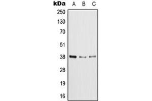 Western blot analysis of XRCC4 expression in HeLa (A), MCF7 (B), NIH3T3 (C) whole cell lysates. (XRCC4 antibody  (C-Term))