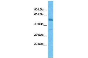 Host:  Rabbit  Target Name:  TMEFF2  Sample Type:  Colorectal Tumor lysates  Antibody Dilution:  1. (TMEFF2 antibody  (C-Term))