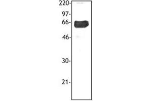 Image no. 1 for anti-Triggering Receptor Expressed On Myeloid Cells 1 (TREM1) antibody (ABIN205544) (TREM1 antibody)