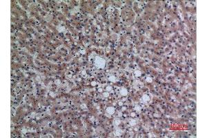 Immunohistochemistry (IHC) analysis of paraffin-embedded Human Liver, antibody was diluted at 1:100. (DPP7 antibody  (C-Term))