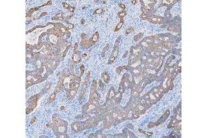 IHC analysis of Cytokeratin 8/KRT8 using anti-Cytokeratin 8/KRT8 antibody (ABIN5518853). (KRT8 antibody  (AA 107-325))