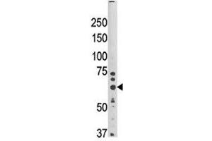 Western blot analysis of HRD1 antibody and mouse brain tissue lysate. (SYVN1 antibody  (AA 58-88))