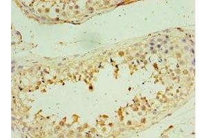 Immunohistochemistry of paraffin-embedded human testis tissue using ABIN7171237 at dilution of 1: 100 (STX3 antibody  (AA 1-263))