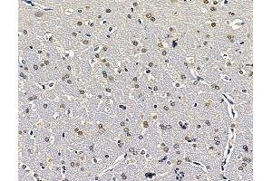 ABIN7096457 and ABIN7100521 at 1/100 staining rat brain tissue by IHC-P. (EXOSC9 antibody)