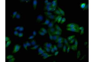 Immunofluorescence staining of HepG2 cells with ABIN7173778 at 1:50, counter-stained with DAPI. (TNFAIP8L1 antibody  (AA 1-186))