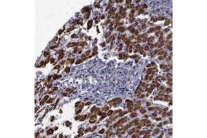 Immunohistochemical staining (Formalin-fixed paraffin-embedded sections) of human liver with MAP3K9 polyclonal antibody  shows strong cytoplasmic positivity in hepatocytes.