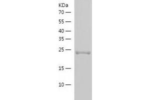 Western Blotting (WB) image for Methyl-CpG Binding Domain Protein 4 (MBD4) (AA 68-300) protein (His tag) (ABIN7284724) (MBD4 Protein (AA 68-300) (His tag))