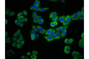 Immunofluorescence staining of PC-3 cells with ABIN7163650 at 1:66, counter-stained with DAPI. (PLEKHG5 antibody  (AA 821-957))