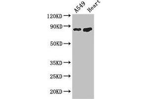 Western Blot Positive WB detected in: A549 whole cell lysate, Mouse heart tissue All lanes: PFKM antibody at 3. (PFKM antibody  (AA 166-334))