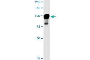 MARK2 monoclonal antibody (M01), clone 3B12. (MARK2 antibody  (AA 401-500))