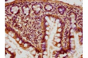 IHC image of ABIN7153827 diluted at 1:400 and staining in paraffin-embedded human small intestine tissue performed on a Leica BondTM system. (RABGGTB antibody  (AA 2-331))