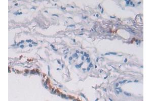 DAB staining on IHC-P; Samples: Human Pancreas Tissue (P4HA2 antibody  (AA 207-520))
