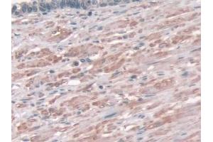 Detection of AASS in Human Prostate Tissue using Polyclonal Antibody to Aminoadipate Semialdehyde Synthase (AASS) (AASS antibody  (AA 33-455))