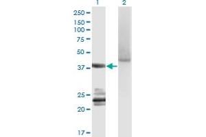 Western Blot analysis of GNA14 expression in transfected 293T cell line by GNA14 monoclonal antibody (M06A), clone 2H8. (GNa14 antibody  (AA 150-250))
