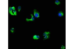 Immunofluorescence staining of MCF-7 cells with ABIN7156768 at 1:66, counter-stained with DAPI. (IL1R2 antibody  (AA 79-219))