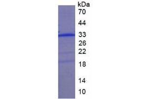 SDS-PAGE analysis of Human Collectin Liver 1 Protein. (COLEC10 Protein)
