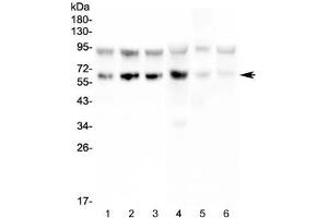 Western blot testing of PD1 antibody and Lane 1:  Jurkat (PD-1 antibody  (AA 101-288))