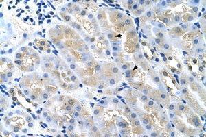 Image no. 1 for anti-Tumor Susceptibility Gene 101 (TSG101) (AA 121-170) antibody (ABIN202410) (TSG101 antibody  (AA 121-170))