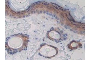 Detection of CD244 in Rat Skin Tissue using Polyclonal Antibody to Cluster of Differentiation 244 (CD244) (2B4 antibody  (AA 20-221))