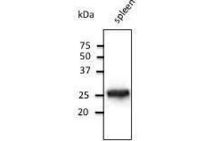 Anti-Rab14 Ab at 1/500 dilution, lysates at 50 µg per Iane, rabbit polyclonal to goat lµg (HR? (RAB5 antibody  (C-Term))