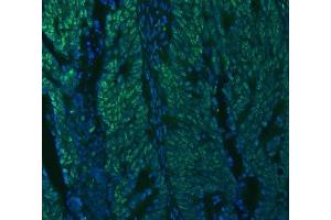 anti-Small Nuclear Ribonucleoprotein Polypeptide A (SNRPA) (AA 25-218) antibody