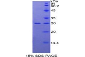SDS-PAGE (SDS) image for Meningioma Expressed Antigen 5 (Hyaluronidase) (MGEA5) (AA 19-222) protein (His tag) (ABIN2121729)