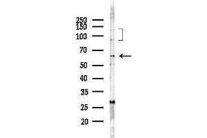 Western blot analysis of lysates from COLO205 cells(heat-shock,45 min treatment), using SELE/CE Antibody at 1/1000 dilution.