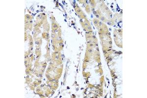 Immunohistochemistry of paraffin-embedded human stomach using COL9A1 antibody (ABIN5975036) at dilution of 1/100 (40x lens).