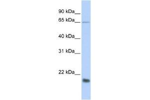 WB Suggested Anti-MUC1 Antibody Titration:  0.